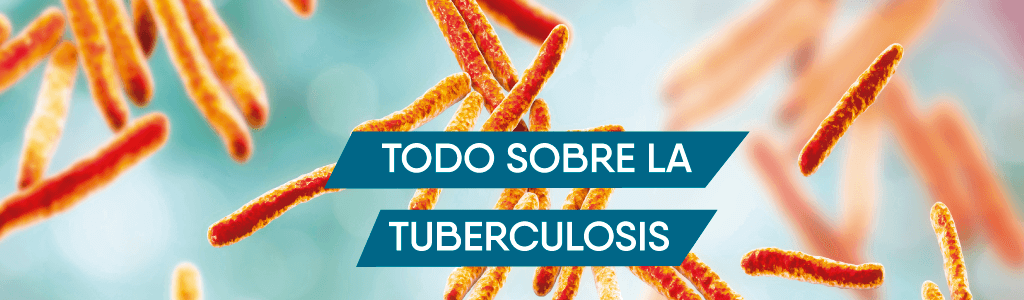 todo sobre la tuberculosis