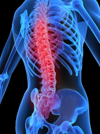 medula espinal - OSTEOARTROSIS