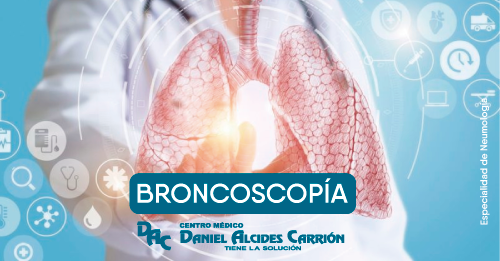 broncoscopía