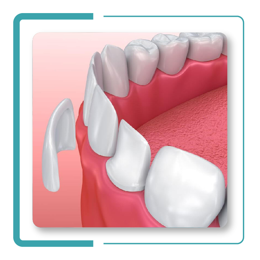 JPG 11 - Procedimientos de Odontología