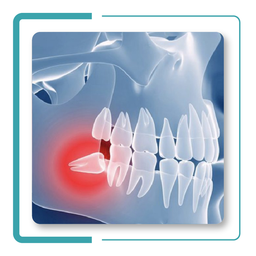 JPG 12 - Procedimientos de Odontología