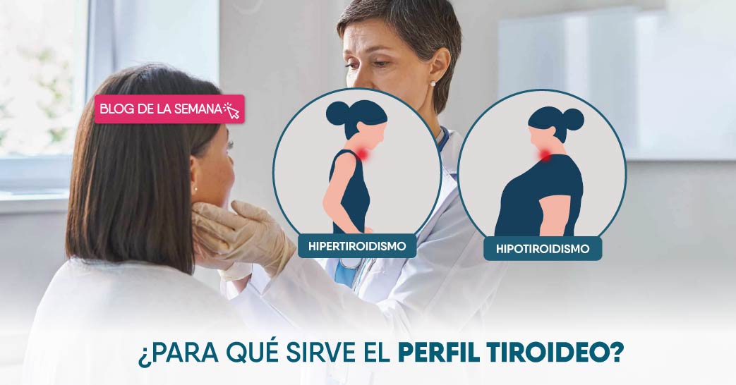 ¿Qué es y para qué sirve el perfil tiroideo? | Endocrinología